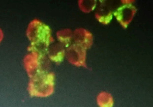 蛍光発色している感染細胞（NA-C1300細胞）<br />ウイルス増殖を示す（緑色） 